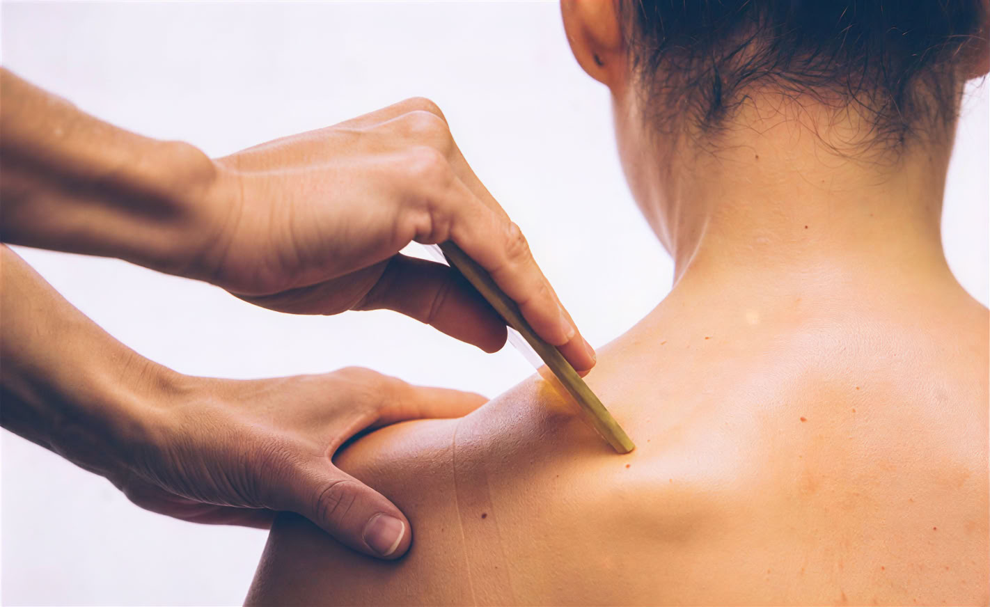 Närande liv i LA • Akupunktur och kinesisk medicin