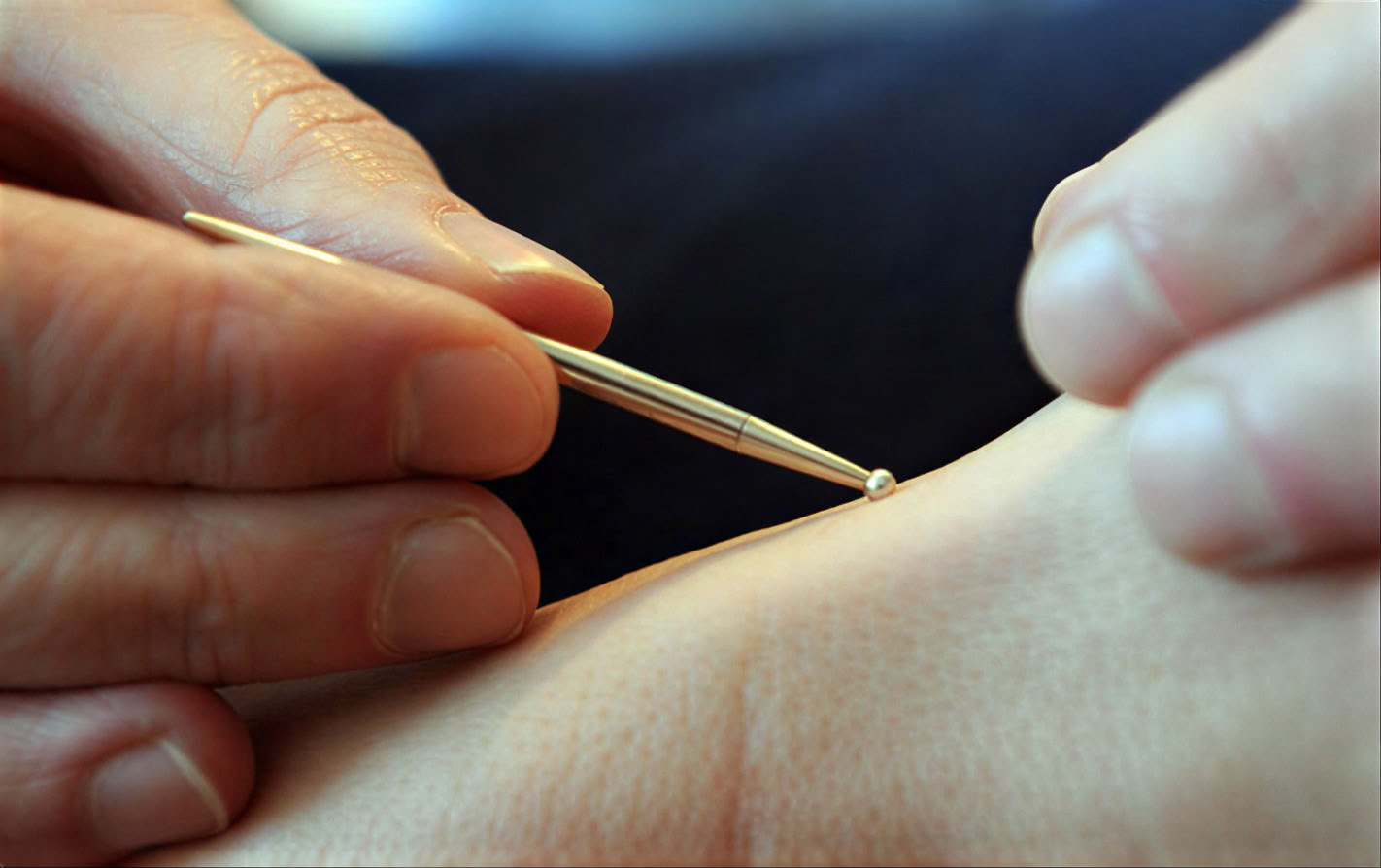 Närande liv i LA • Akupunktur och kinesisk medicin